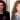 shania twain plastic surgery